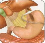 Realize band3 - Realize band3